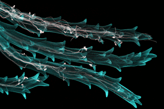 Take a microscopic view of the ergot fungus (light pink colour) infecting wheat stigma hairs (blue colour)  the winning photo from NIAB and Cambridge University in the Wellcome Image Awards 